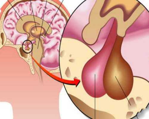 输卵管堵塞有什么征兆