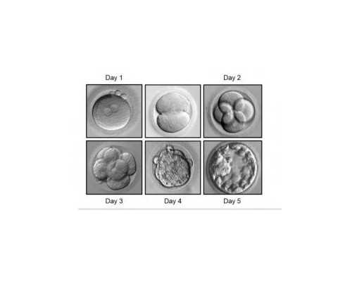 深圳哪家医院捐卵速度快,深圳哪家医院可以捐卵做供卵试管?附深圳试管医院