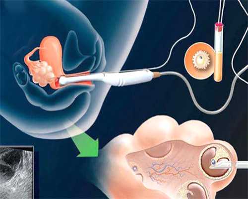 代孕怎么收费的,
              做amh检查抽血前要禁水禁食吗？
            