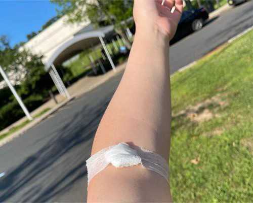 代孕电话怎么找,手术消除多囊卵巢？多囊卵巢手术？