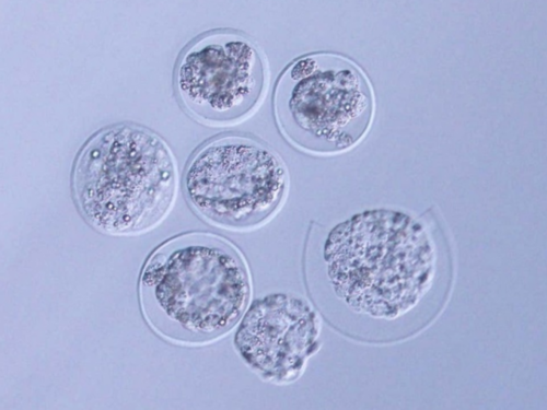 深圳助孕好的医院,深圳有哪些医院提供三代试管婴儿服务!附费用及其介绍!