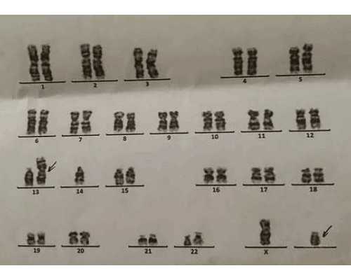 深圳试管供卵代孕医院,深圳有试管成功的医院吗_深圳哪里有试管婴儿！