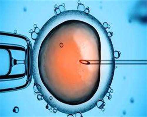 哪些人适合做第三代试管婴儿呢