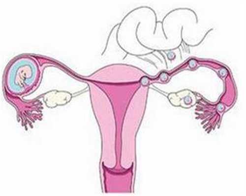 没有卵巢可以做深圳代孕吗,婴儿肚脐贴怎么拿下
