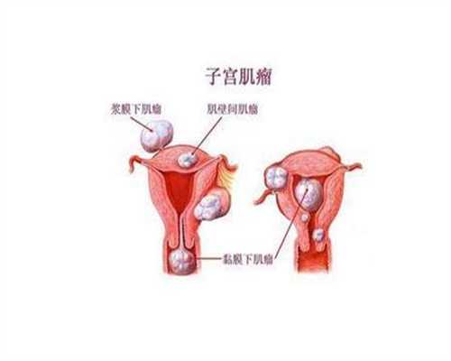 专业深圳代孕成功率,卵巢储备下降是更常见女性