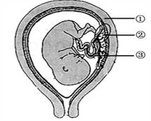 为儿子深圳代孕,子宫内膜异位症常见六个信号
