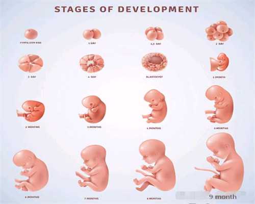 供卵医生~做试管婴儿的流程流产到底分为哪几种